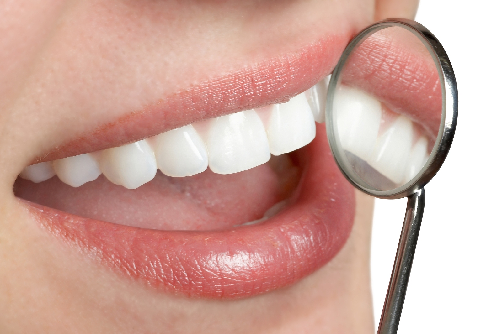 Dental Sealants