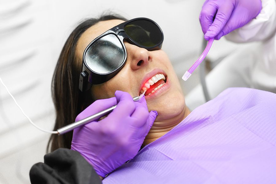 Solea Laser – The Latest in Dental Technology