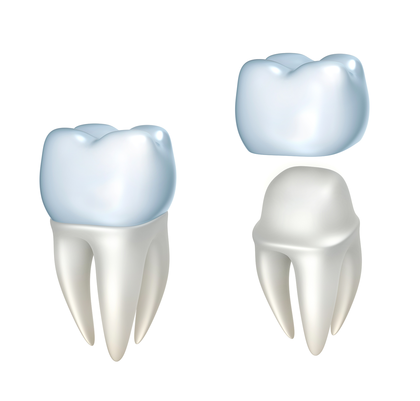 CEREC (Same Day Crowns): Revolutionizing Dental Care in Corvallis, OR