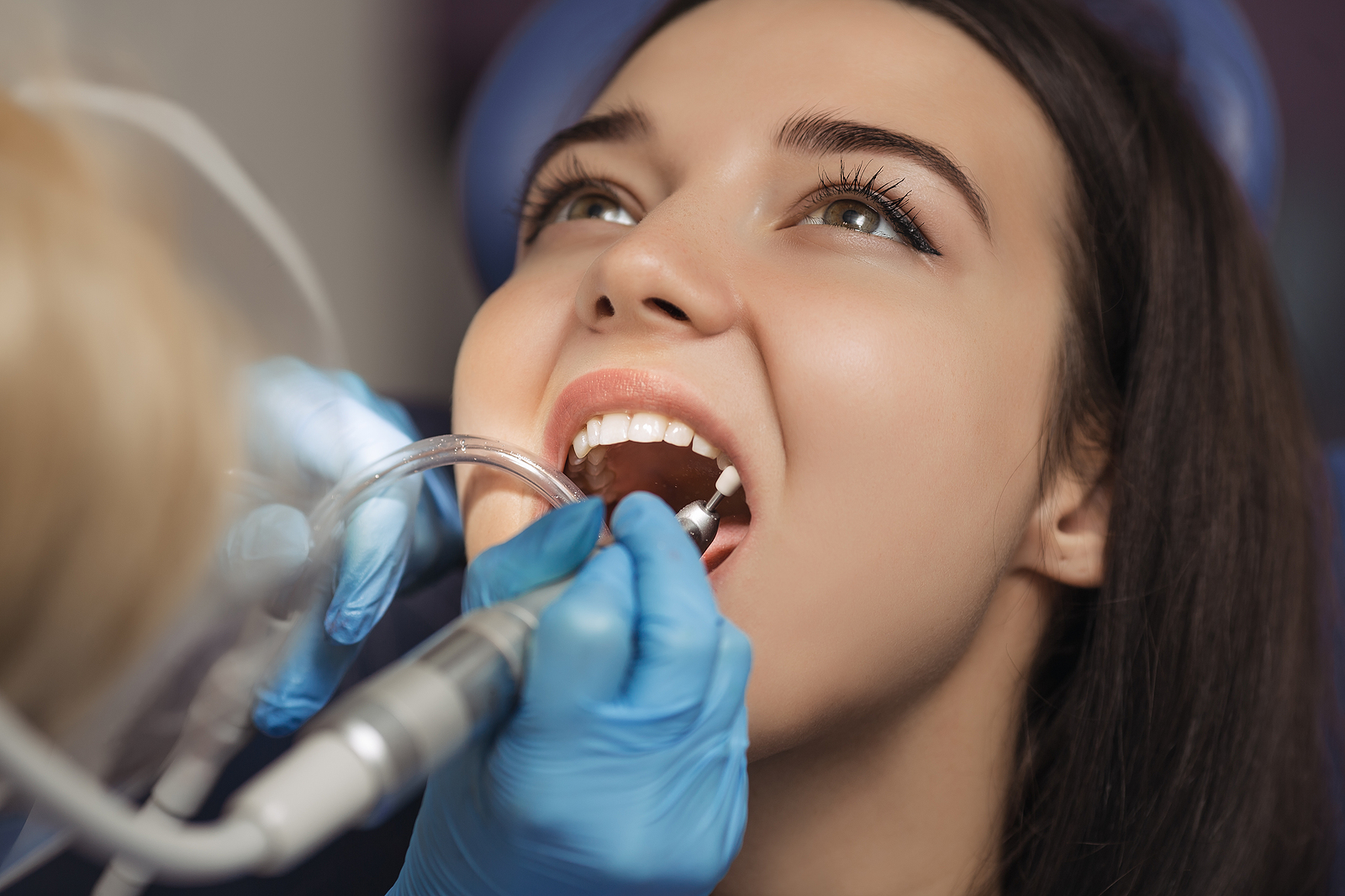 Top Essential Tips for a Smooth Recovery After Oral Surgery