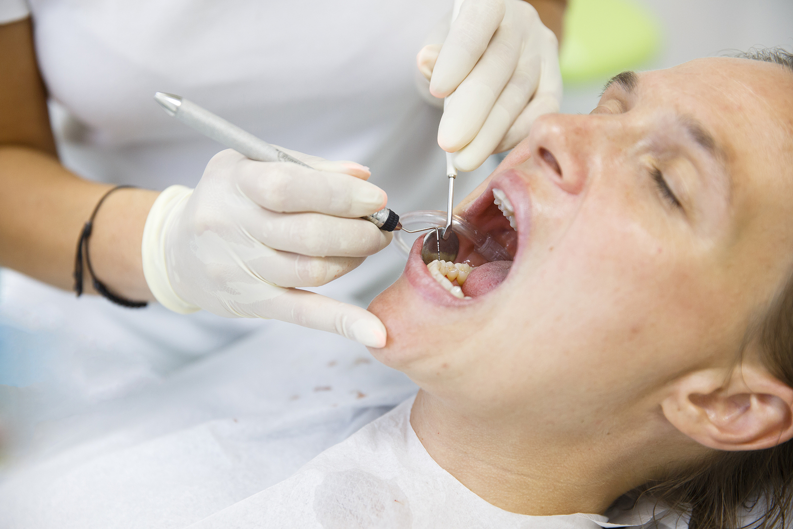 Root Canal vs. Tooth Extraction: Which Is the Best Option for You?